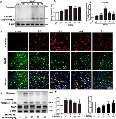Inhibition of Caspase-1 Ameliorates Ischemia-Associated Blood-Brain Barrier Dysfunction and Integrity by Suppressing Pyroptosis Activation